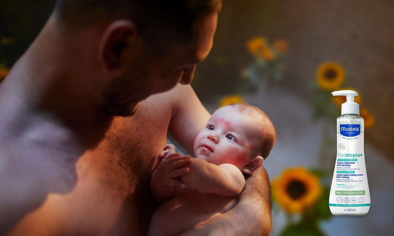 BENU Atopisch eczeem bij kinderen: hoe verzorg ik de huid van mijn baby? Eczéma atopique chez l'enfant : comment soigner la peau de bébé ?